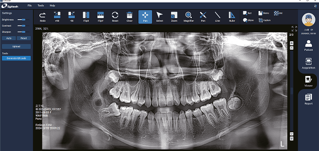 Панорамный снимок Eighteeth FinScan F350
