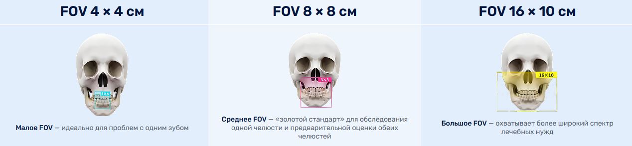 Поля обзора FinScan F350: 4×4, 8×8 и 16×10 см